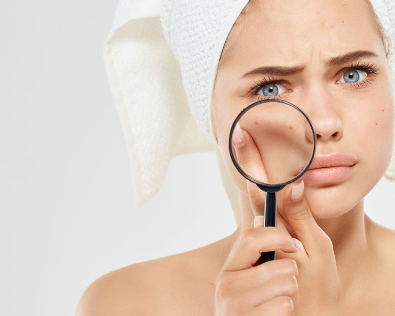 Hautarzt Wien - Dermatologe & Ästhetische Zentrum in Wien - Hautarzt Wien - Dermatologe Dermatologie-Akne