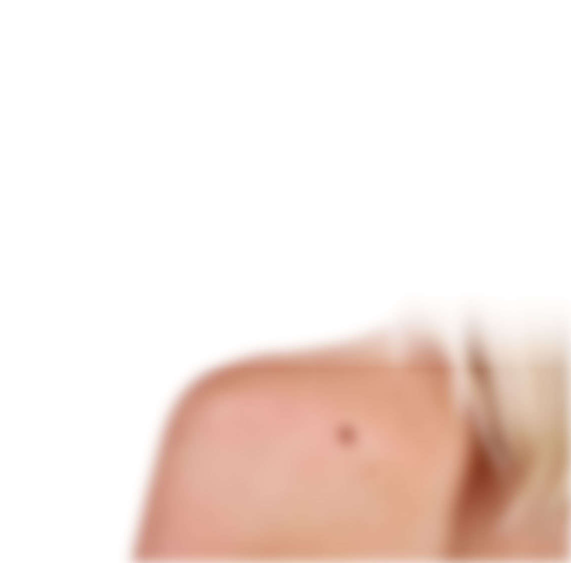 Hautarzt Wien - Dermatologe & Ästhetische Zentrum in Wien - Hautarzt Wien - Dermatologe Dermatologie & Ästhetische