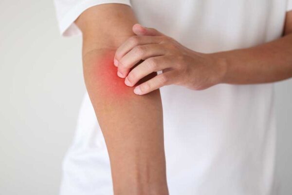 Hautarzt Wien - Dermatologe & Ästhetische Zentrum in Wien - Hautarzt Wien - Dermatologe Kol | Hautarzt Wien - Dermatologe & Ästhetische Zentrum in Wien
